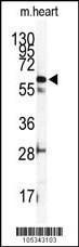 Anti-ILK Rabbit Polyclonal Antibody (HRP (Horseradish Peroxidase))