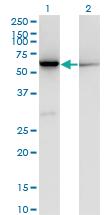 Anti-CBS Mouse Monoclonal Antibody [clone: 3D10]