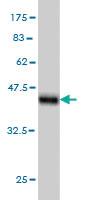 Anti-FARSB Mouse Monoclonal Antibody [clone: 2F11]