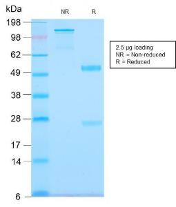 SDS-PAGE analysis of Anti-Tenascin C Antibody [TNC/2981R] under non-reduced and reduced conditions; showing intact IgG and intact heavy and light chains, respectively SDS-PAGE analysis confirms the integrity and purity of the antibody