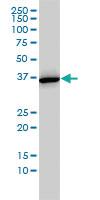 Anti-ANXA2 Mouse Monoclonal Antibody [clone: 1G7]