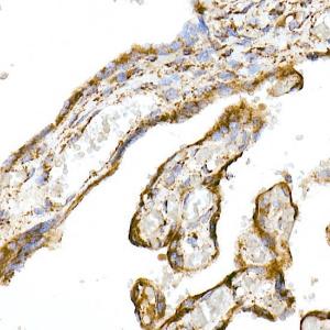 Immunohistochemistry analysis of paraffin-embedded human placenta using Anti-TOMM20 Antibody [ARC5002-01] (A309191) at a dilution of 1:50(40x lens) Perform microwave antigen retrieval with 10 mM Tris/EDTA buffer pH 90 before commencing with IHC staining protocol