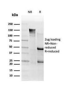 SDS-PAGE analysis of Anti-SMNDC1 Antibody [PCRP-SMNDC1-1A9] under non-reduced and reduced conditions; showing intact IgG and intact heavy and light chains, respectively. SDS-PAGE analysis confirms the integrity and purity of the Antibody