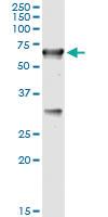 Anti-CBS Mouse Monoclonal Antibody [clone: 3D10]