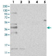 Anti-FAM110C Rabbit Polyclonal Antibody