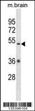 Anti-CAMKV Rabbit Polyclonal Antibody (APC (Allophycocyanin))