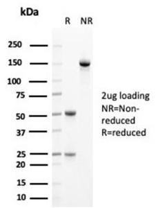 SDS-PAGE analysis of Anti-Cytokeratin 14 Antibody [KRT14/4125] under non-reduced and reduced conditions; showing intact IgG and intact heavy and light chains, respectively SDS-PAGE analysis confirms the integrity and purity of the antibody