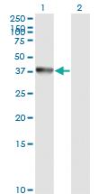 Anti-ANXA2 Mouse Monoclonal Antibody [clone: 1G7]