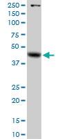 Anti-GLA Rabbit Polyclonal Antibody