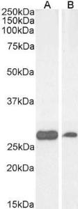 Anti-PGAM1/PGAM2/PGAM4 Antibody (A83678) (0.03 µg/ml) staining of Human Cerebellum (A) and Liver (B) lysate (35 µg protein in RIPA buffer). Detected by chemiluminescence