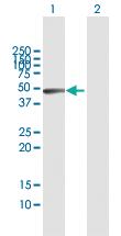 Anti-GLA Rabbit Polyclonal Antibody