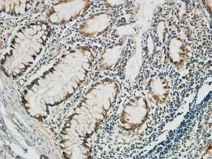 Immunohistochemical analysis of paraffin-embedded human colon using Anti-PGD Antibody