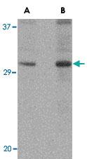 Anti-DNAL1 Rabbit Polyclonal Antibody