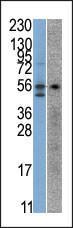 Anti-STK38 Rabbit Polyclonal Antibody (PE (Phycoerythrin))