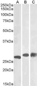 Anti-PGAM1/PGAM2/PGAM4 Antibody (A83678) (0.03 µg/ml) staining of Mouse (A), Rat (B) and Pig (C) Liver lysate (35 µg protein in RIPA buffer). Detected by chemiluminescence