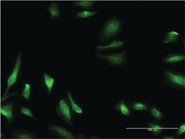 Anti-CBS Mouse Monoclonal Antibody [clone: 3D10]