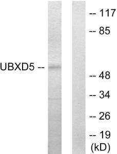 Western blot analysis of lysates from HepG2 cells using Anti-UBXD5 Antibody. The right hand lane represents a negative control, where the Antibody is blocked by the immunising peptide