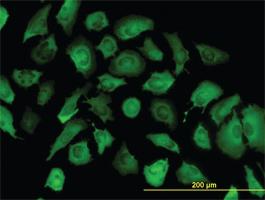 Anti-ANXA2 Mouse Monoclonal Antibody [clone: 1G7]