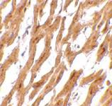 Anti-ASAH1 Rabbit Polyclonal Antibody