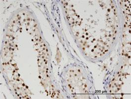 Anti-TDP2 Mouse Monoclonal Antibody [clone: 3D11]