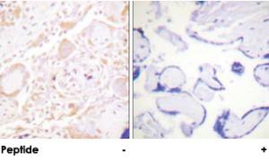 Anti-GATA3 Rabbit Polyclonal Antibody