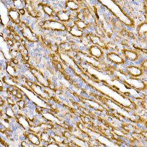 Immunohistochemistry analysis of paraffin-embedded mouse kidney using Anti-TOMM20 Antibody [ARC5002-01] (A309191) at a dilution of 1:50(40x lens) Perform microwave antigen retrieval with 10 mM Tris/EDTA buffer pH 90 before commencing with IHC staining protocol