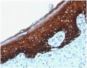 Immunohistochemical analysis of formalin-fixed, paraffin-embedded human skin tissue using Anti-Cytokeratin 14 Antibody [KRT14/4125] at 2 µg/ml