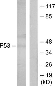 Antibody anti-P53 A98460-100 100 µg