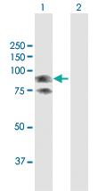 Anti-GLB1 Rabbit Polyclonal Antibody