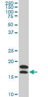 Anti-NME2 Mouse Monoclonal Antibody [clone: 1A9]