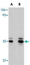 Anti-ASAH1 Rabbit Polyclonal Antibody