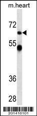 Anti-CNOT4 Mouse Monoclonal Antibody [clone: 343CT14.6.5]