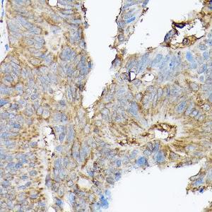 Antibody anti-SLC8A1 100 µl