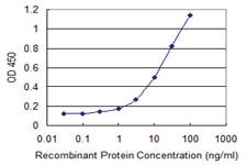 Anti-TDP2 Mouse Monoclonal Antibody [clone: 3D11]