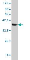 Anti-S100 A11 Mouse Monoclonal Antibody [clone: 2F4]