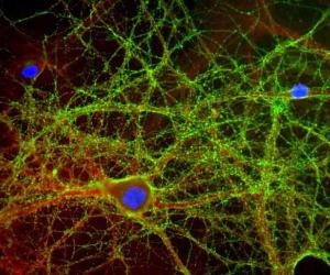 Mixed neuron-glial cultures stained with Anti-GAP43 Antibody (green) and Anti- rabbit antibody to alpha-II spectrin (A85352 / red), and DNA (blue)