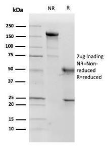 SDS-PAGE analysis of Anti-p57 Kip2 Antibody [KP10] under non-reduced and reduced conditions; showing intact IgG and intact heavy and light chains, respectively. SDS-PAGE analysis confirms the integrity and purity of the Antibody