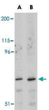 Anti-ASAH2 Rabbit Polyclonal Antibody