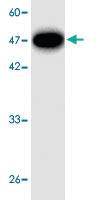 Anti-Legionella pneumophila mip Mouse Monoclonal Antibody [clone: 33v5]