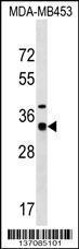 Anti-MYOZ2 Rabbit Polyclonal Antibody (Biotin)