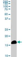 Anti-NME2 Mouse Monoclonal Antibody [clone: 1A9]