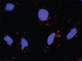 Anti-BIRC3 + IKBKB Antibody Pair