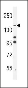 Anti-His6-DEP-1 Rabbit Polyclonal Antibody (APC (Allophycocyanin))