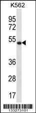 Anti-APOBEC3G Rabbit Polyclonal Antibody (FITC (Fluorescein Isothiocyanate))