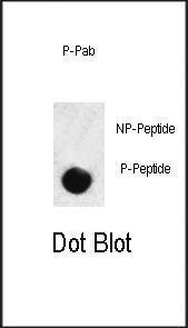 Anti-SMAD3 Rabbit Polyclonal Antibody (APC (Allophycocyanin))