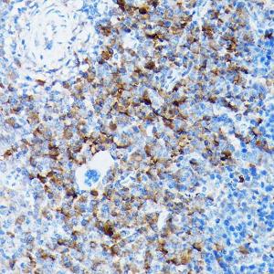 Antibody anti-SLC8A1 100 µl