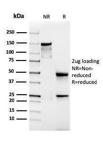 SDS-PAGE analysis of Anti-Podocalyxin Antibody [rPODXL/2184] under non-reduced and reduced conditions; showing intact IgG and intact heavy and light chains, respectively. SDS-PAGE analysis confirms the integrity and purity of the antibody