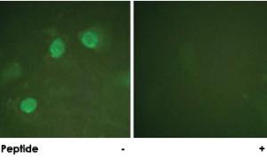 Anti-GATA3 Rabbit Polyclonal Antibody