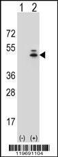 Anti-ACTG1 Rabbit Polyclonal Antibody