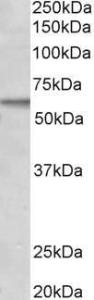 Anti-ACVRL1 Antibody (A83682) (2 µg/ml) staining of MCF7 lysate (35 µg protein in RIPA buffer). Primary incubation was 1 hour. Detected by chemilu minescence